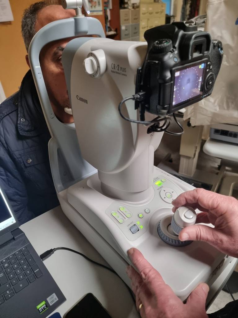 Used Canon CR-2 Plus Digital Hybrid Retinal Camera available in Villefranche sur Saône Exam view 1