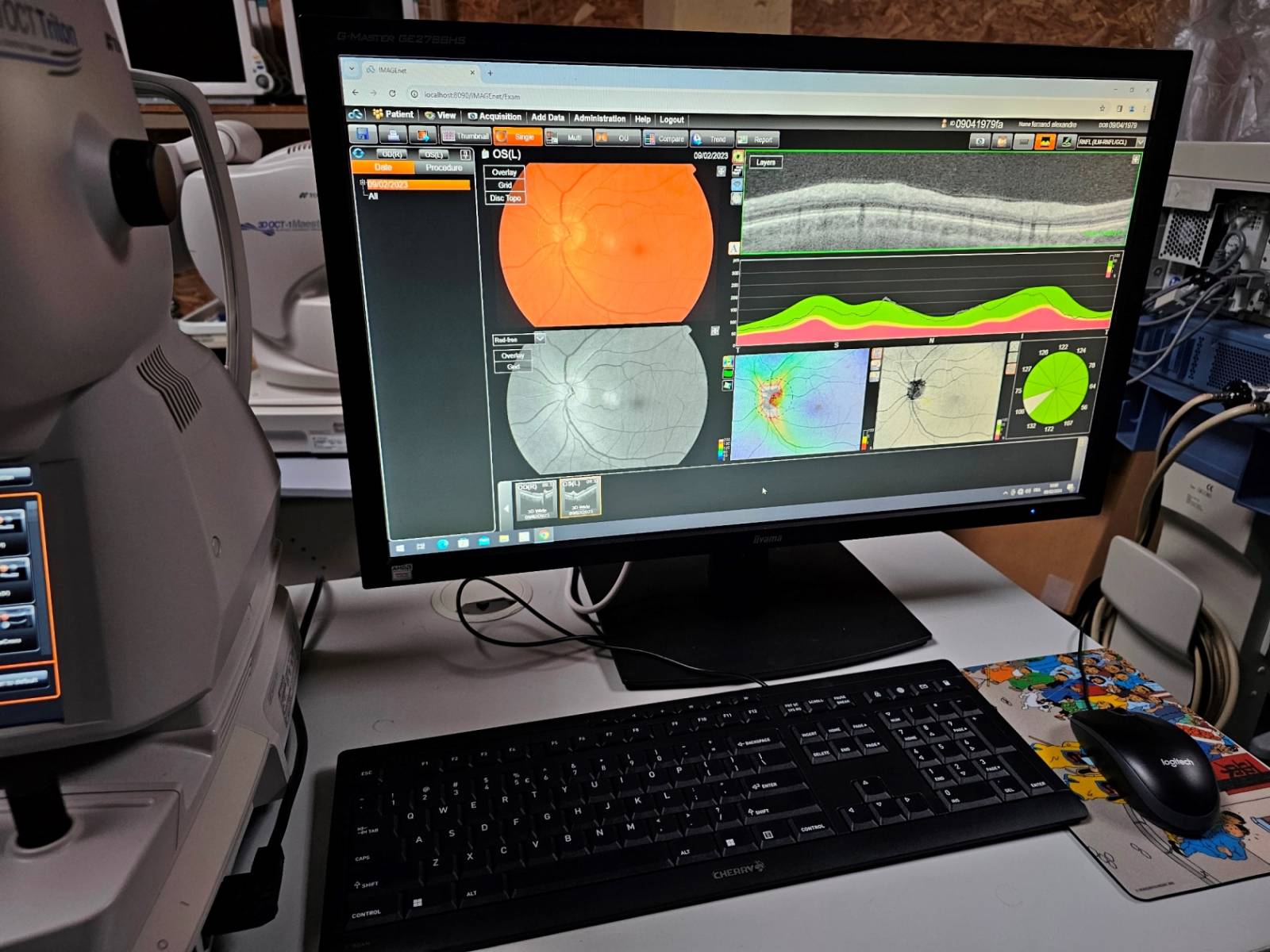 TOPCON TRITON OCT Exam view 2